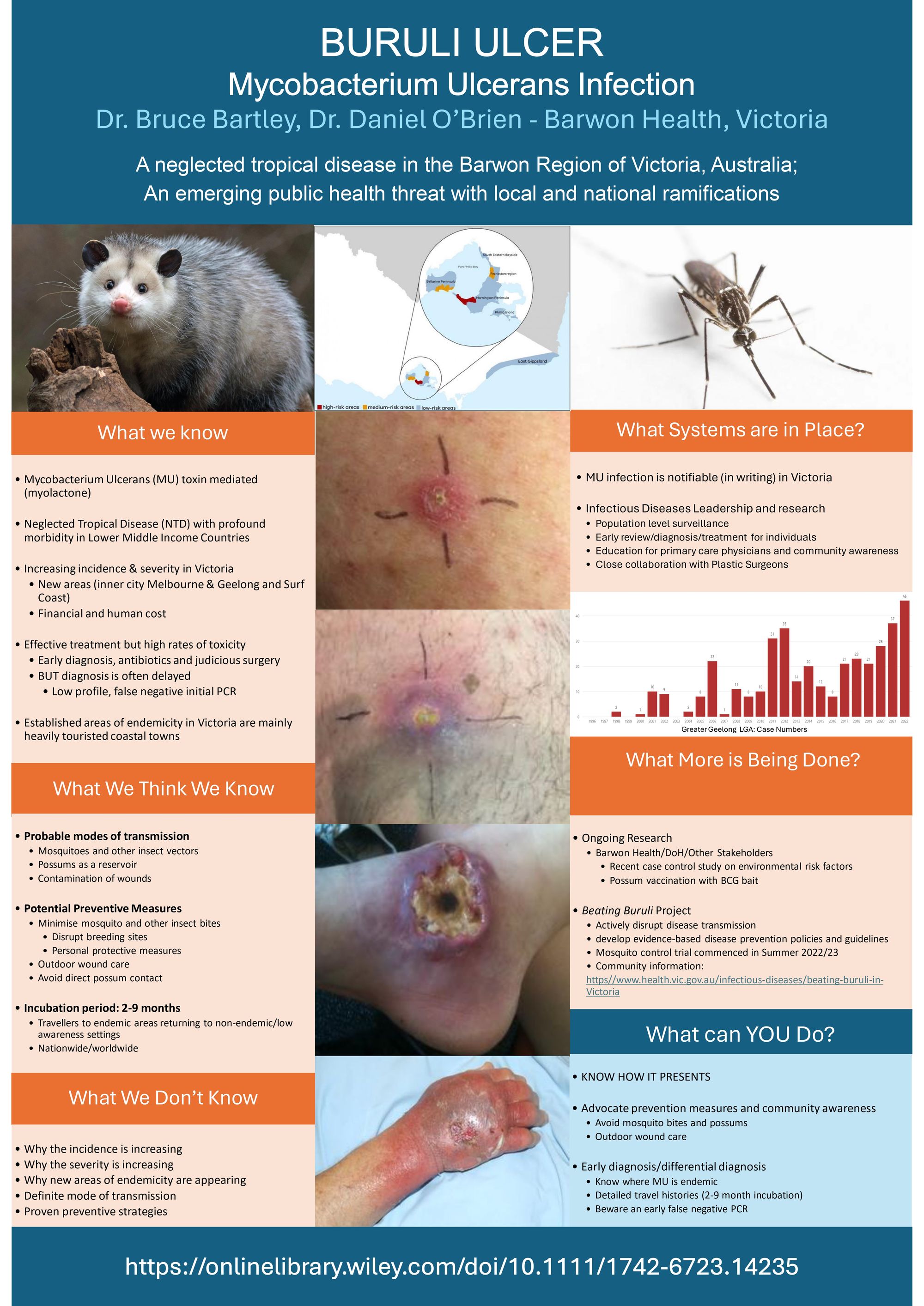 Buruli ulcer – A neglected tropical disease in the Barwon region of Victoria, Australia: An emerging public health threat with local and national ramifications